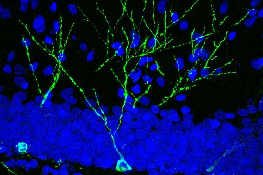 Neurones hipocampals en desenvolupament, marcades en verd, d'una rata jove adulta - Imatge: Cedida a l'ACN per la UAB