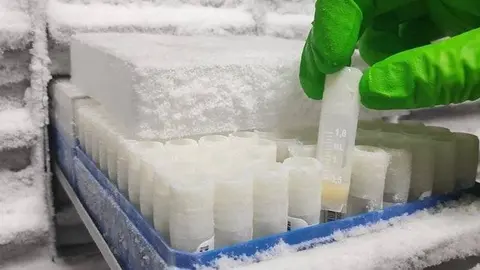 Mostres recollides al Biobanc de l'IRBLleida de pacients amb covid-19