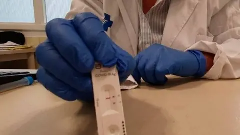 Testos antigènics ràpids (TAR)