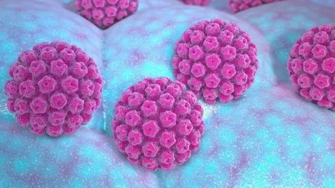 Virus del papil·loma humà