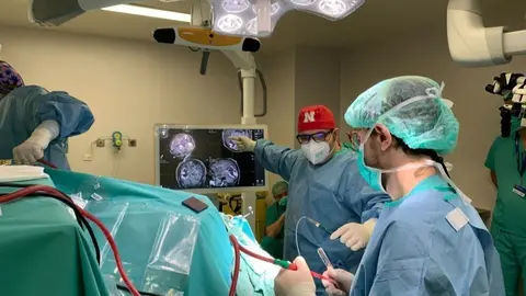 Neurocirurgians a quiròfan ©Hospital Arnau de Vilanova