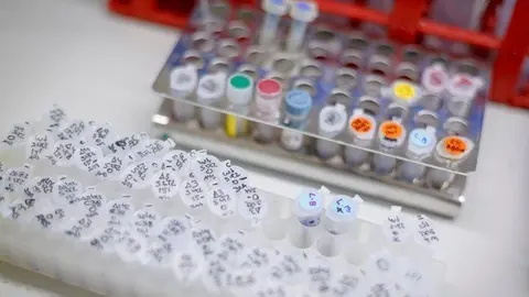 L'IRBLleida ©IRBLleida