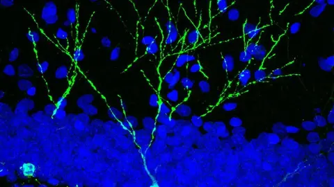 Neurones hipocampals en desenvolupament, marcades en verd, d'una rata jove adulta - Imatge: Cedida a l'ACN per la UAB